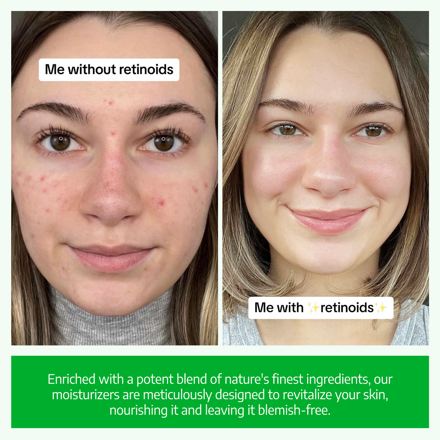 Before and After Retinol Cream